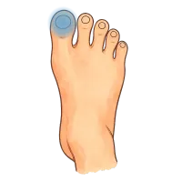 The Toe